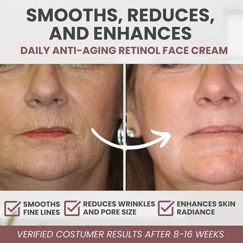 Instant Retinol Cream – Anti-Wrinkle Firming Moisturizer