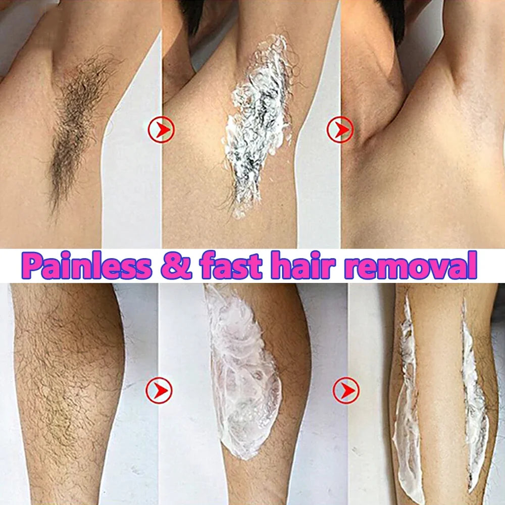 Permanent Hair Removal Cream – Painless Epilator for Intimate Areas