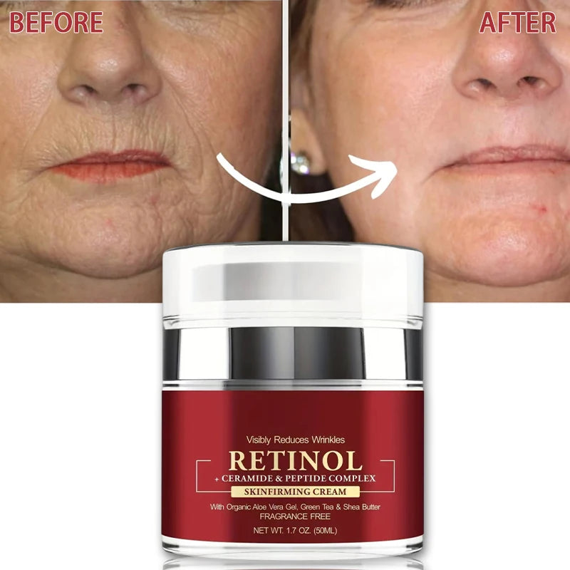 Instant Retinol Cream – Anti-Wrinkle Firming Moisturizer