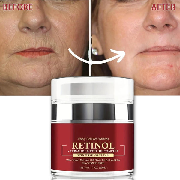 Instant Retinol Cream – Anti-Wrinkle Firming Moisturizer